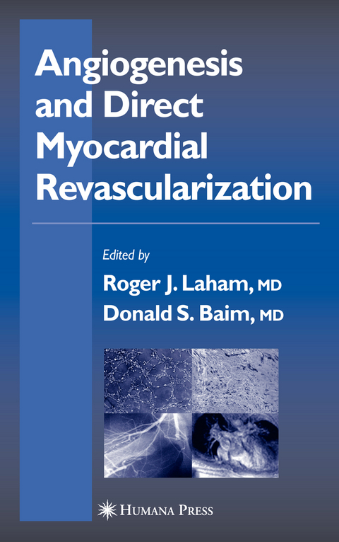 Angiogenesis and Direct Myocardial Revascularization - 