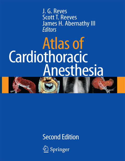 Atlas of Cardiothoracic Anesthesia - 