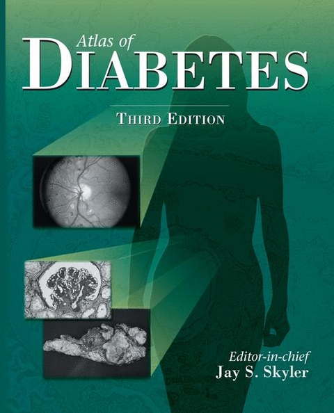 Atlas of Diabetes - 