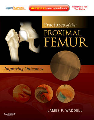 Fractures of the Proximal Femur: Improving Outcomes - James P. Waddell