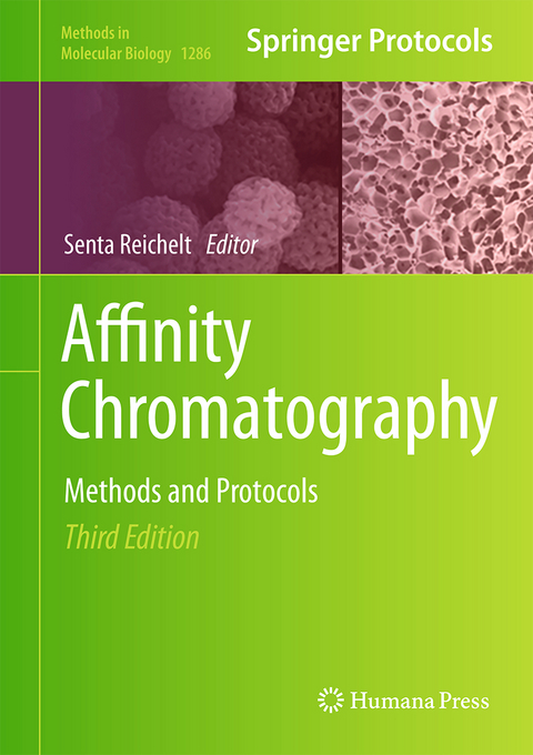 Affinity Chromatography - 