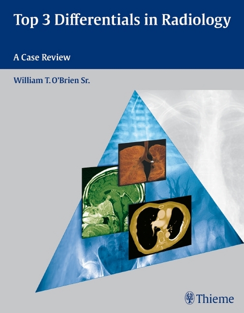 Top 3 Differentials in Radiology - William T. O'Brien