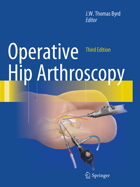 Operative Hip Arthroscopy - 