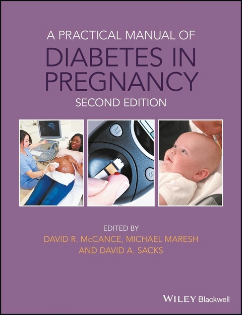 A Practical Manual of Diabetes in Pregnancy - 