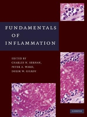 Fundamentals of Inflammation - 