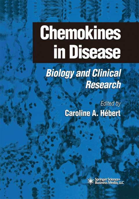 Chemokines in Disease - 