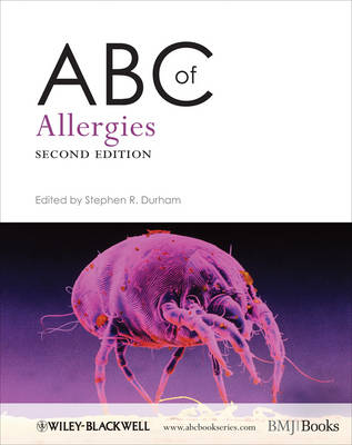 ABC of Allergies 2e - SR Durham