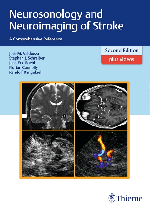 Neurosonology and Neuroimaging of Stroke - José Manuel Valdueza, Stephan Schreiber, Jens-Eric Röhl, Florian Connolly, Randolf Klingebiel