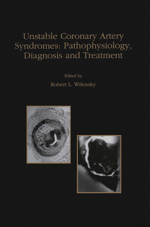 Unstable Coronary Artery Syndromes Pathophysiology, Diagnosis and Treatment - Robert L. Wilensky