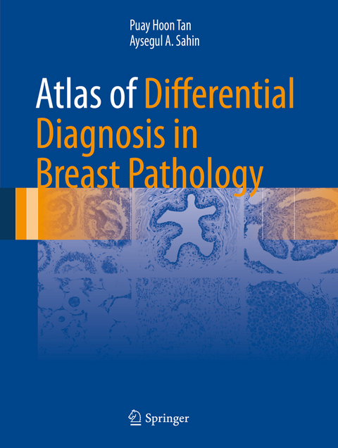 Atlas of Differential Diagnosis in Breast Pathology - Puay Hoon Tan, Aysegul A. Sahin