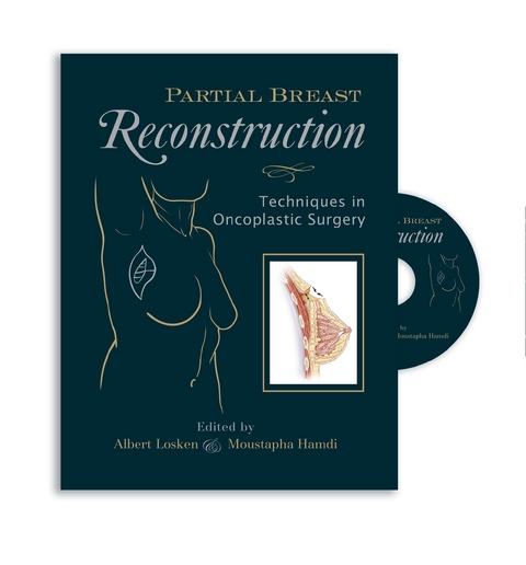 Partial Breast Reconstruction: Techniques in Oncoplastic Surgery - 