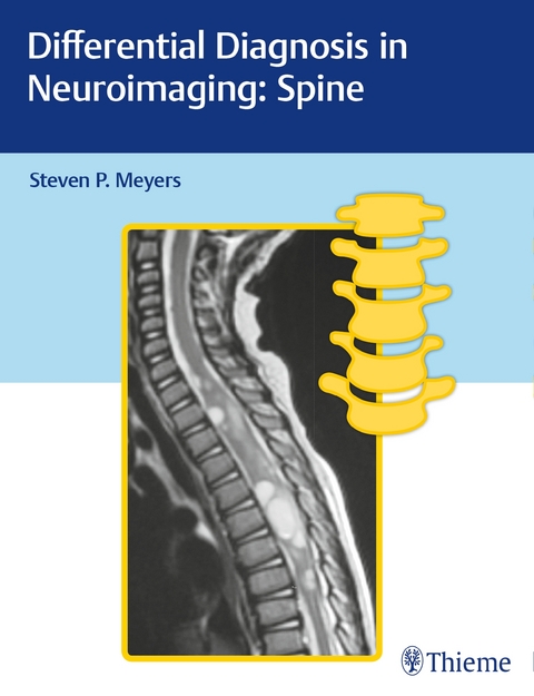 Differential Diagnosis in Neuroimaging - 