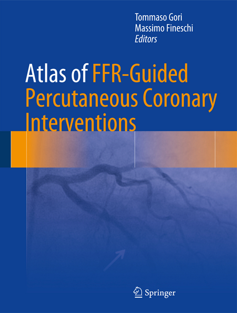 Atlas of FFR-Guided Percutaneous Coronary Interventions - 