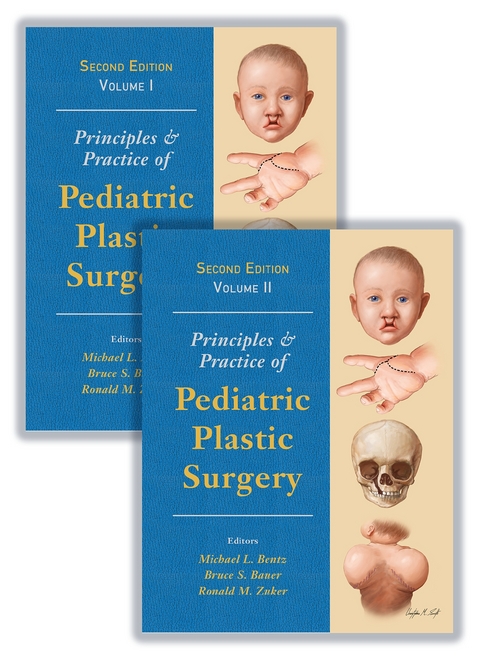 Principles and Practice of Pediatric Plastic Surgery - 