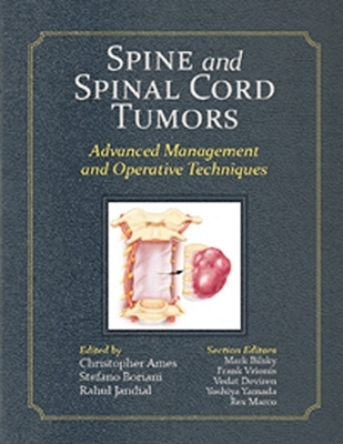 Spine and Spinal Cord Tumors - 