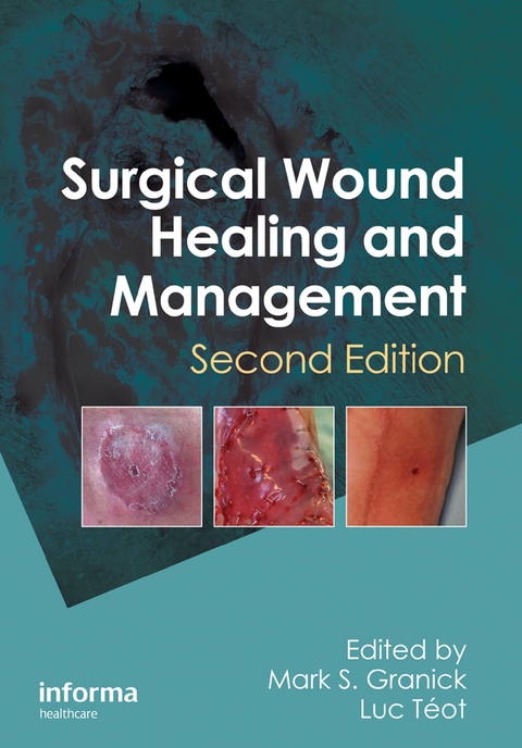 Surgical Wound Healing and Management - 