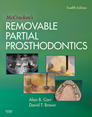 McCracken's Removable Partial Prosthodontics - Alan B. Carr, David T. Brown