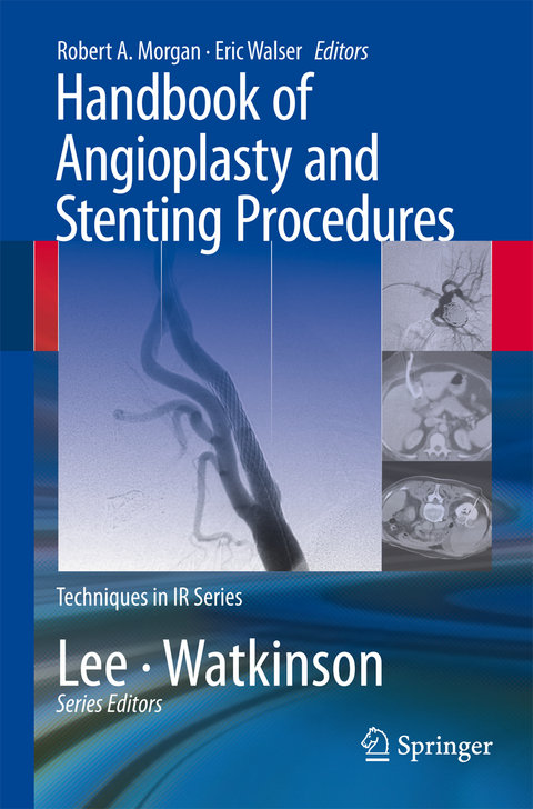 Handbook of Angioplasty and Stenting Procedures - 