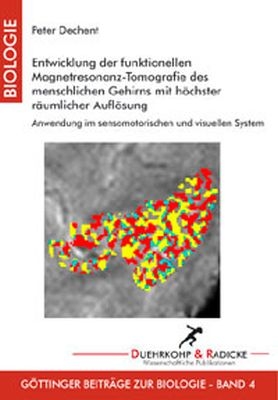 Entwicklung der funktionellen Magnetresonanz-Tomografie des menschlichen Gehirns mit höchster räumlicher Auflösung - Peter Dechent