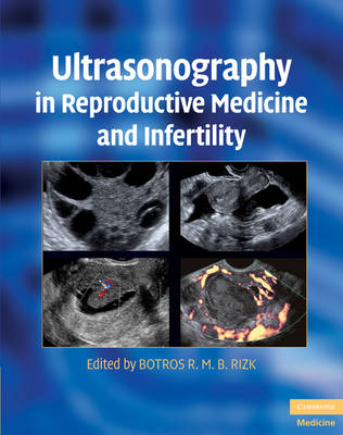 Ultrasonography in Reproductive Medicine and Infertility - 