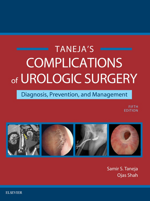 Complications of Urologic Surgery E-Book -  Samir S. Taneja,  Ojas Shah