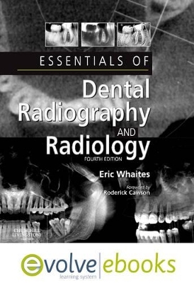 Essentials of Dental Radiography and Radiology - Eric Whaites