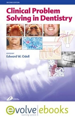 Clinical Problem Solving in Dentistry - Edward W. Odell