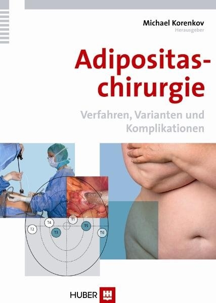 Adipositaschirurgie - 