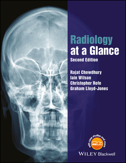 Radiology at a Glance - Rajat Chowdhury, Iain Wilson, Christopher Rofe, Graham Lloyd-Jones