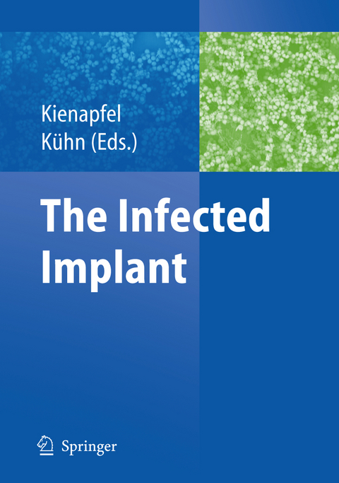 The Infected Implant - 