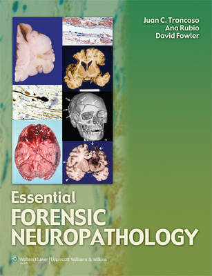 Essential Forensic Neuropathology - 