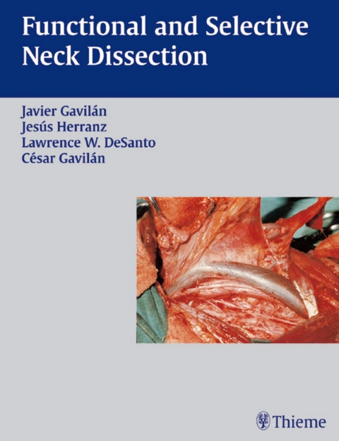 Functional and Selective Neck Dissection - Javier Gavilan, Lawrence W. De Santo