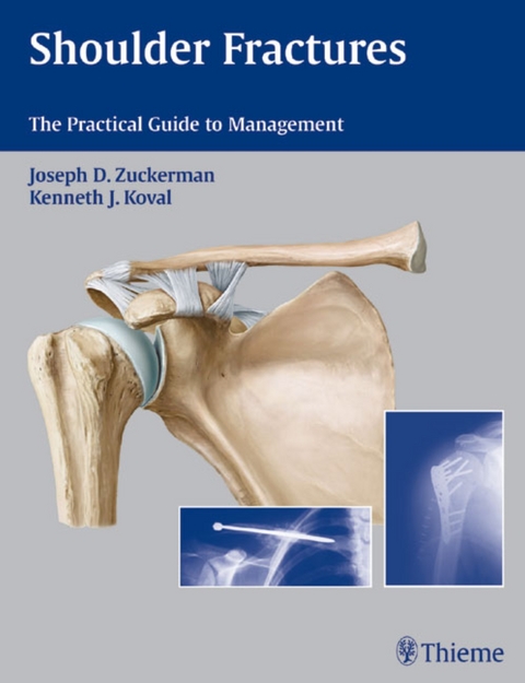 Shoulder Fractures - 