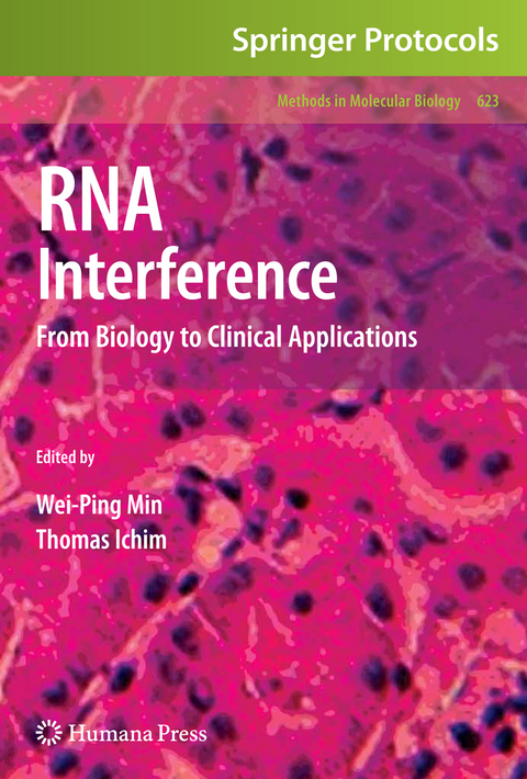 RNA Interference - 