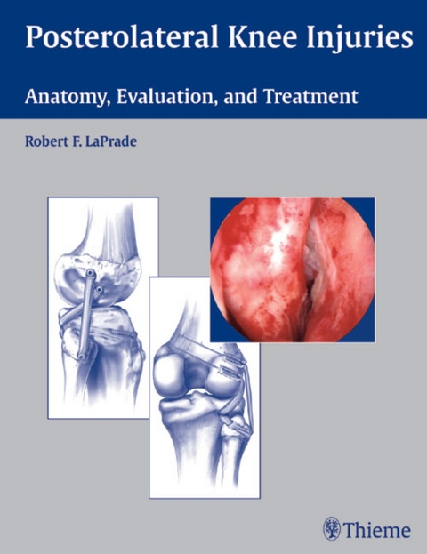 Posterolateral Knee Injuries - Robert F. LaPrade