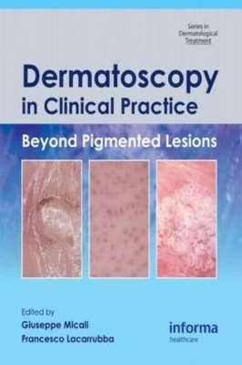 Dermatoscopy in Clinical Practice - 