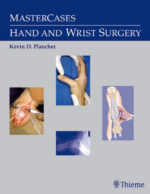 MasterCases in Hand and Wrist Surgery - 