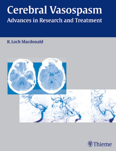 Cerebral Vasospasm - R. Loch Macdonald