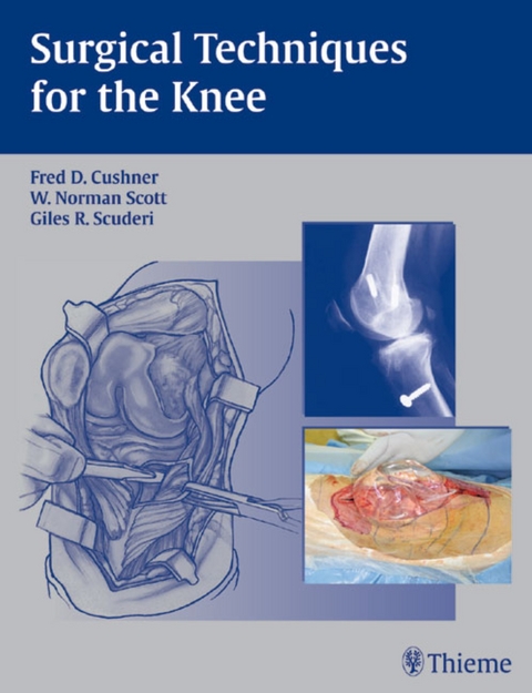 Surgical Techniques for the Knee - 