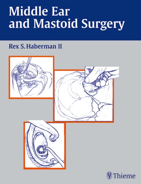 Middle Ear and Mastoid Surgery - 