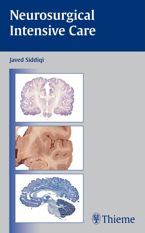 Neurosurgical Intensive Care - 