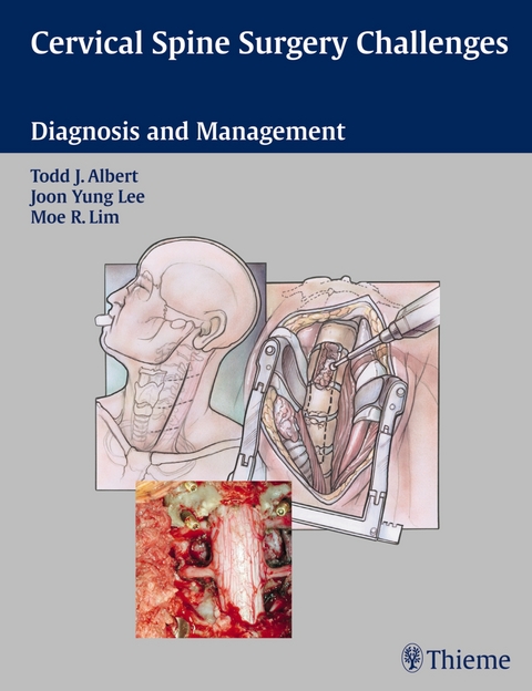 Cervical Spine Surgery Challenges - 