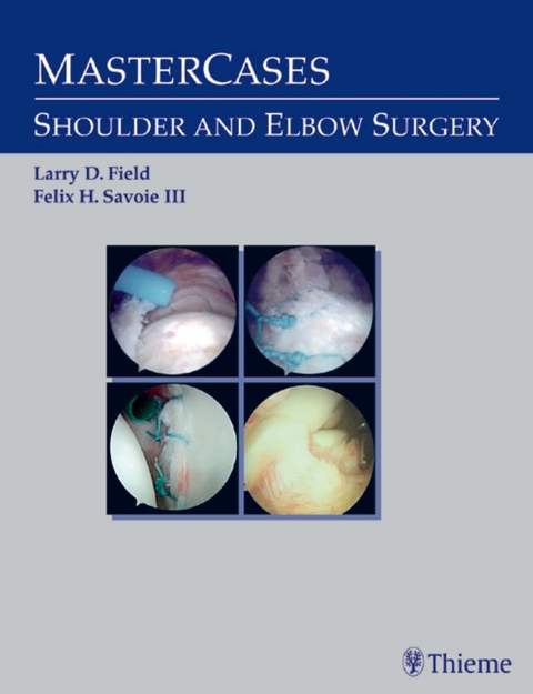 MasterCases in Shoulder and Elbow Surgery - 