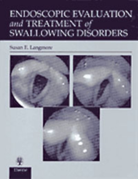 Endoscopic Evaluation and Treatment of Swallowing Disorders - Susan Langmore