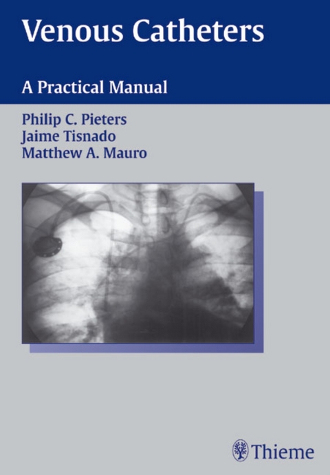 Venous Catheters - Philip C. Pieters, Jaime Tisnado, Matthew A. Mauro