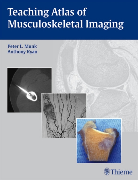 Teaching Atlas of Musculoskeletal Imaging - Peter L. Munk