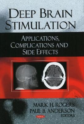 Deep Brain Stimulation - Mark H Rogers, Paul B Anderson