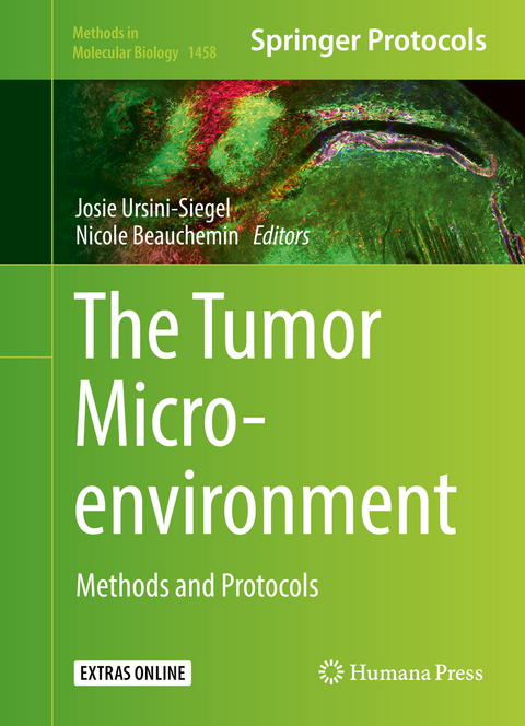 The Tumor Microenvironment - 