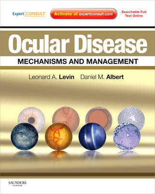 Ocular Disease: Mechanisms and Management - Leonard A Levin, Daniel M. Albert