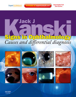 Signs in Ophthalmology: Causes and Differential Diagnosis - Jack J. Kanski